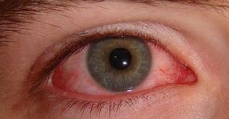 PRVI SIMPTOM DIJABETESA : Rani znak da vam šećer razara organizam