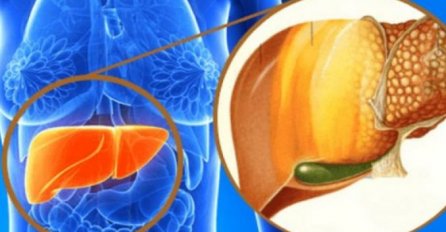 REKLI SU MI DA IMAM MASNU JETRU I DA JE OPASNO: A onda mi je svekrva napravila prirodni napitak, SPASILA ME (RECEPT)