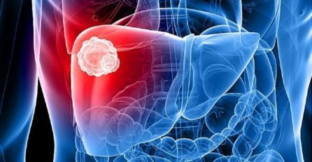 Važne informacije o slučajevima hepatitisa kod djece registrovanim od SZO