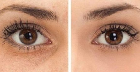 GENIJALAN TRIK HOLIVUDSKIH ŠMINKERA: Briše podočnjake za minut!