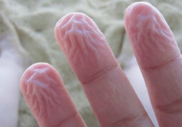 NIJE ZA ŠALU: Evo zašto vam se prsti smežuraju poslije kupanja - OVO JE PRAVI RAZLOG