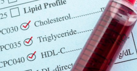 KAKO SE TUMAČI KRVNA SLIKA: Evo šta sve znače one skraćenice i njihove vrijednosti!