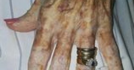 POUČNA PRIČA: Vaše ruke pričaju priču o vašem životu