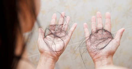 Zašto kosa opada? 4 razloga koja morate znati