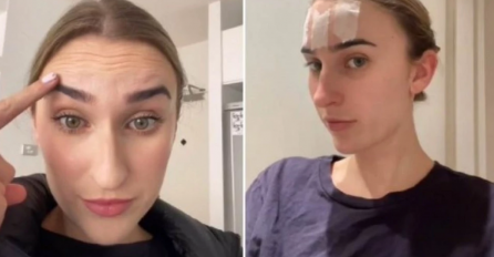 7 DANA JE SPAVALA SA SELOTEJPOM NA ČELU: Rezultat je nevjerovatan, hirurg otkriva da li stvarno ima efekta!