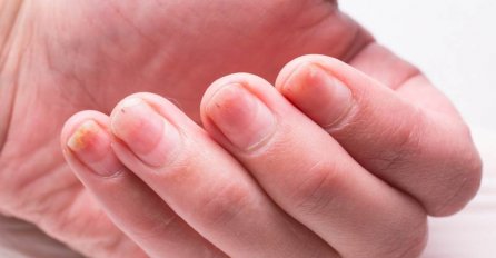 Ova boja noktiju otkriva šokantne detalje o vašem zdravlju: Pogledajte šta vas čeka!