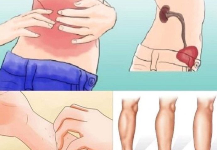 KAD SA BUBREZIMA NIJE SVE U REDU, TIJELO ŠALJE OVE SIGNALE: 6 simptoma koje ne smijete ignorisati!