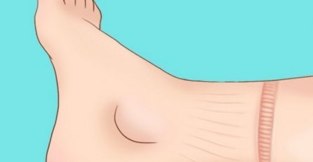 4 UPOZORAVAJUĆA  ZNAKA DA VAM SRCE SLABO RADI: Mnogi obrate pažnju na ove znakove KAD BUDE VEĆ KASNO!