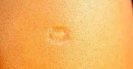 SVI KOJI SU ROĐENI U BIVŠOJ JUGI IMAJU OVAJ OŽILJAK NA LIJEVOM RAMENU: Znate li kako je nastao?