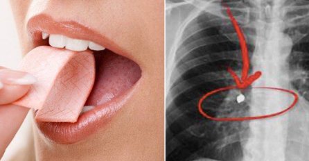 Mislili ste da će vam se zalijepiti za crijeva, ali istina je drugačija: Evo šta se desi u stomaku kada progutate ŽVAKU