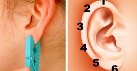 ONA SVAKOGA DANA PRITISKA UHO ŠTIPALJKOM: Rezultati su nevjerovatni! (VIDEO)