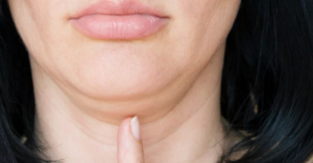 JEDINI NAČIN DA SE RIJEŠITE  PODBRATKA NA LICU JE OVAJ: Prirodne metode i MASKA koju ćete sami napraviti i sigurno ga se RIJEŠITI!