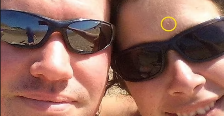 ŽENA MISLILA DA JE OVO NA ČELU SAMO OGREBOTINA,  A ONDA SU JOJ DOKTORI OTKRILI ZASTRAŠUJUĆE VIJESTI: Sada upozorava sve, NEMOJTE PRAVITI ISTU GREŠKU KAO I ONA