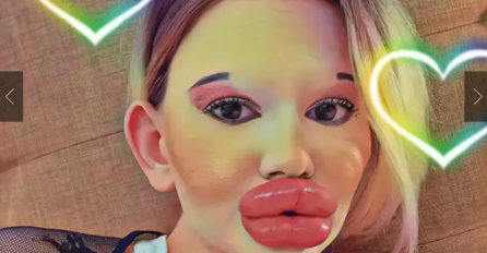 ANDREA, ZAŠTO? SRCE ĆE VAS ZABOLJETI KAD VIDITE KAKO JE SVE DO NEDAVNO BILA LJEPOTICA: Pogledajte kako je izgledala prije operacija (FOTO)