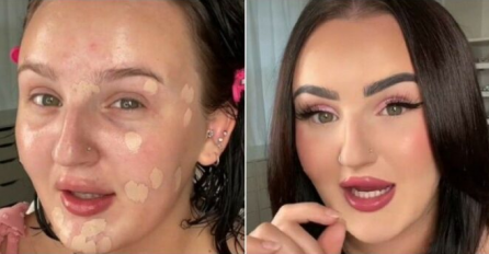 NOVI BEAUTY HIT SA TIK TOKA: Pogledajte kako savršeno prikriti svaku bubuljicu (VIDEO)