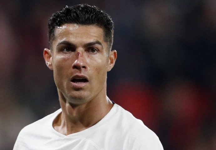 Ronaldo krvav ležao na travi: Medicinski tim hitno reagovao (FOTO)