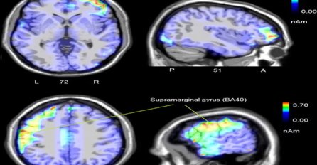 NAUČNICI SNIMILI MOZAK ČOVJEKA NA SAMRTI, DOŠLI DO ZAPANJUJUĆIH PODATAKA: Evo šta se dešava kada zatvore oči