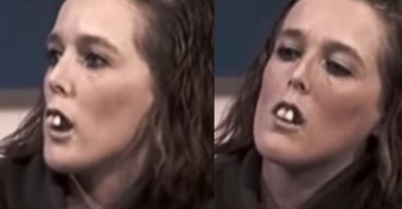 NEKAD SU JE ZVALI ZUBATA ŽENA, uradila je nove zube od 11.200 EURA: Kad vidite kako sada izgleda OČI ĆE VAM STATI - DRUGA ŽENA