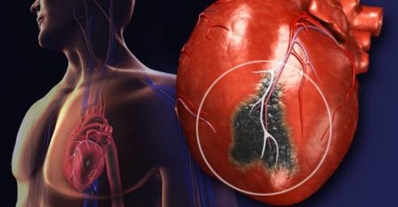 1 SIMPTOM SE POJAVI DAN PRIJE SRČANOG UDARA: Ako osjetite ovaj znak upozorenja - ZOVITE HITNU POMOĆ