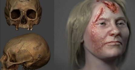 Naučnici otkrili: Kako je izgledala žena koja je prije 500 godina bolovala od opake bolesti?