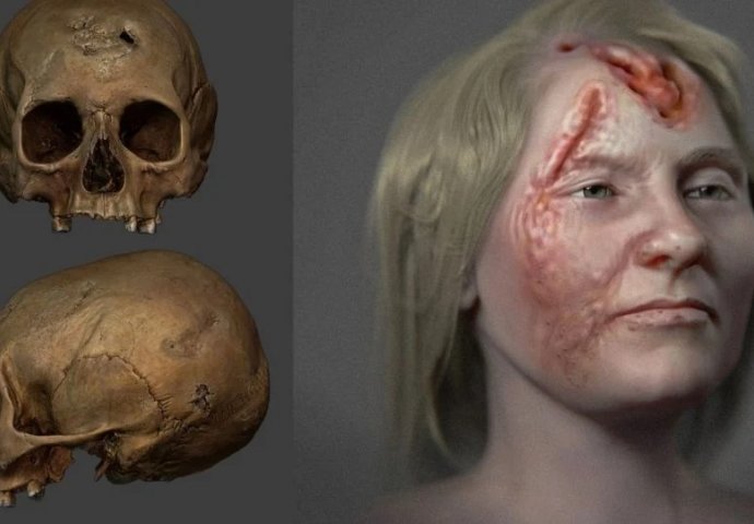 Naučnici otkrili: Kako je izgledala žena koja je prije 500 godina bolovala od opake bolesti?