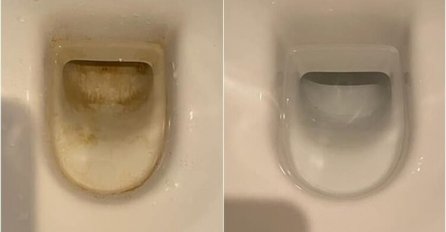 Sljedeći put kad čistili WC šolju, upotrijebite ovo sredstvo: Svi neprijatni mirisi nestaju