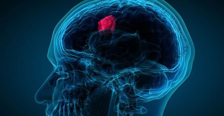 Doktorica tvrdi da ovi simptomi mogu ukazivati na tumor na mozgu
