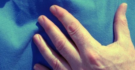 Četiri znaka mogu ukazivati na srčani udar (a jedan skoro nikome ne bi pao na pamet)