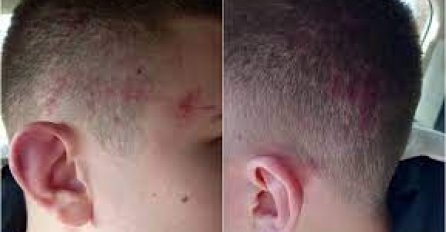 Uhapšena jedna osoba zbog napada na srpskog dečaka u Suvom Dolu