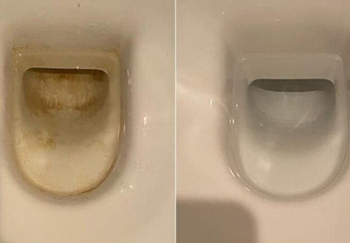 Kada sljedeći put budete čistite WC šolju, upotrebite ovaj proizvod: Sva prljavština i neprijatni mirisi nestaju