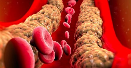Jedan vitamin može značajno smanjiti holesterol, a nalazi se u hrani koju svi jedemo
