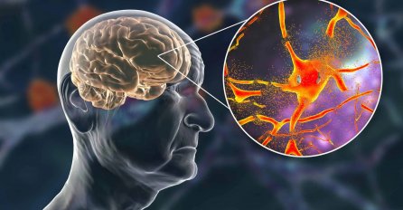 Doktor otkrio koji simptomi otkrivaju da osoba možda razvija demenciju