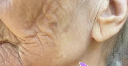 BAKA (96) je cijeli život nosila MARAMU, a razlika između VRATA I LICA JE ZAPREPAŠĆUJUĆA: Kad vidite njen vrat ostat ćete U ŠOKU!