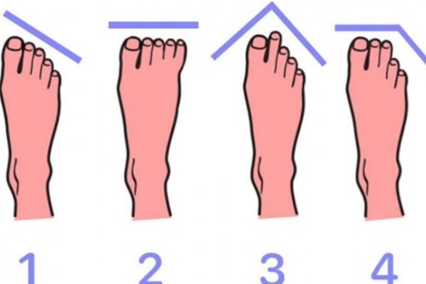 OBLIK VAŠIH STOPALA POKAZUJE KAKAV STE ČOVJEK: Dobro pogledajte noge, otkriće vam mnogo