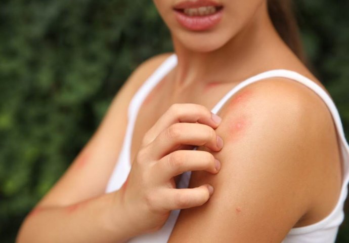 Posadite ove biljke i OTJERAT ĆETE KOMARCE: Ne prilaze vašem vrtu