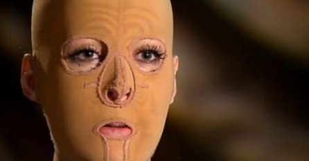 PRELIJEPU SRPKINJU DANU LJUBOMORNA ŽENA ŽIVU JE ZAPALILA: Imala je preko 200 operacija, a danas svi zanijeme kada je vide (FOTO) 