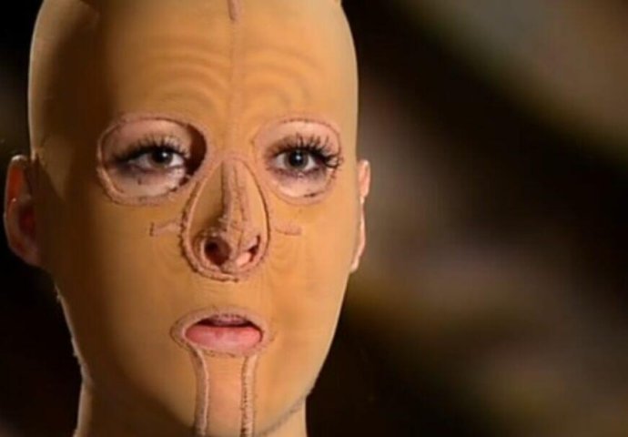 PRELIJEPU SRPKINJU DANU LJUBOMORNA ŽENA ŽIVU JE ZAPALILA: Imala je preko 200 operacija, a danas svi zanijeme kada je vide (FOTO) 