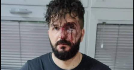 VIŠE OD DVA SATA DAVAO IZJAVU POLICIJI: Dervišević otkrio imena koja smatra odgovornim za napad