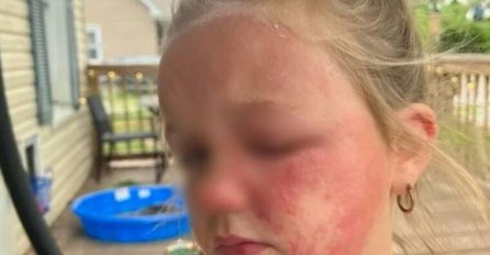 DJEVOJČICA (6) JEDVA PREŽIVJELA ZBOG OTROVNE BILJKE: Raste u dvorištima, izgleda kao bezopasno cvijeće, a ustvari je POGUBNA