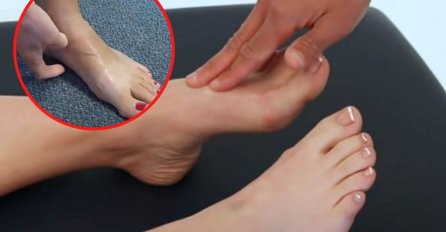 AKO UOČITE 1 ZNAK NA NOZI - IDITE DOKTORU MOMENTALNO: Evo šta ukazuje na visok holesterol