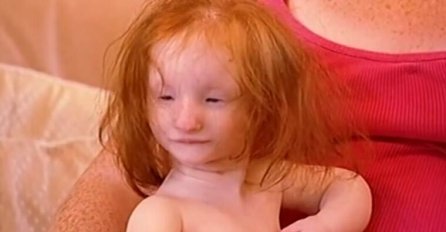 ROĐENA JE KAO PORCELANSKA LUTKA, SVI SU TVRDILI DA ĆE ŽIVJETI 1 GODINU: Evo kako sada izgleda najmanja djevojčica na svijetu