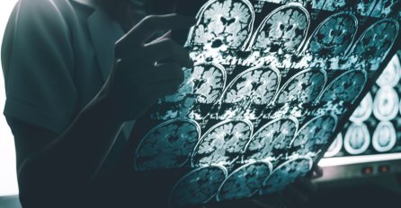 Doktor Kučuk pojasnio cijeli niz znakova koji nas upozoravaju na demenciju: Gubitak pamćenja nije jedini