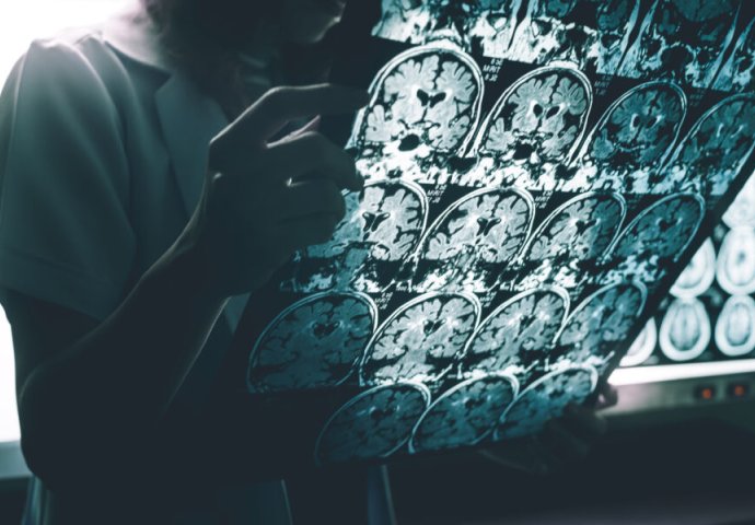 Doktor Kučuk pojasnio cijeli niz znakova koji nas upozoravaju na demenciju: Gubitak pamćenja nije jedini