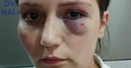 Tužilaštvo optužilo vlasnika hotela Jablanica: EVO ŠTA GA ČEKA ZBOG PREMLAĆIVANJA RADNICE ENISE KLEPO