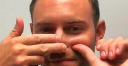 DOKTOR POKAZAO KAKO DA OTPUŠITE NOS ZA 15 SEKUNDI: Ne kupujte KAPI, one mogu da stvore ZAVISNOST i štete SLUZOKOŽI