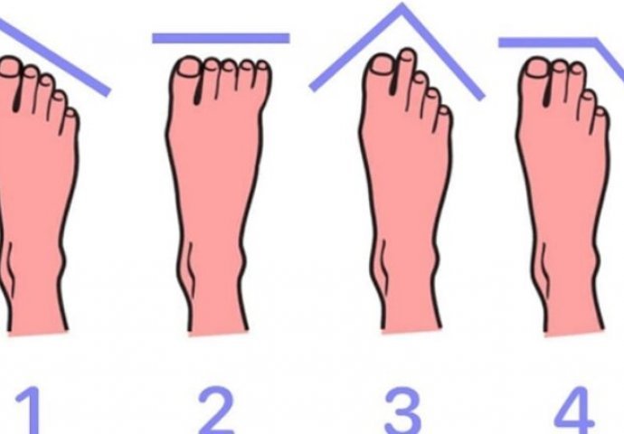 OBLIK VAŠIH STOPALA POKAZUJE KAKAV STE ČOVJEK: Dobro pogledajte noge, otkriće vam mnogo