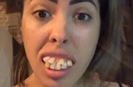 "Imala sam NAJRUŽNIJE ZUBE NA SVIJETU, a onda sam se udala za zubara