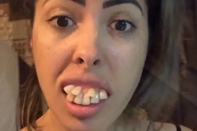 "Imala sam NAJRUŽNIJE ZUBE NA SVIJETU, a onda sam se udala za zubara