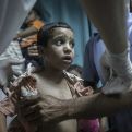 TUGA: Djeca u bolnicama u Gazi umiru zbog dehidracije i pothranjenosti