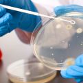 EU odobrila novi antibiotik za borbu protiv superbakterija